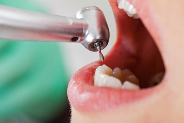 Best Emergency Treatment for Toothache in Wchester, IN